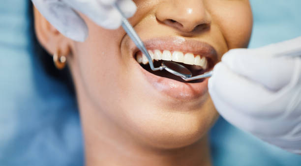Best Emergency Dental Care for Sports Injuries in USA